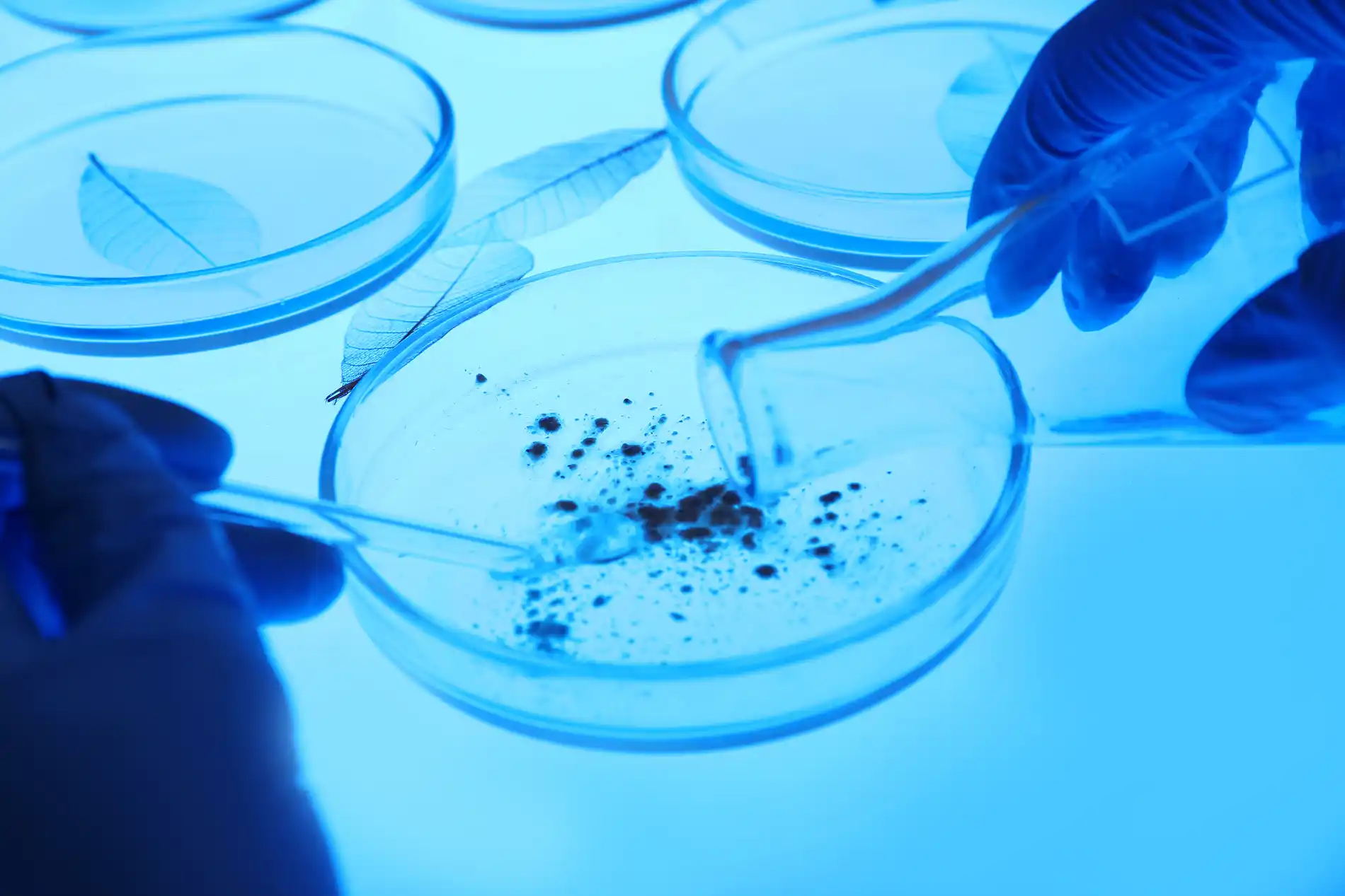 ESPERMOCULTIVO (CULTIVO DEL SEMEN)