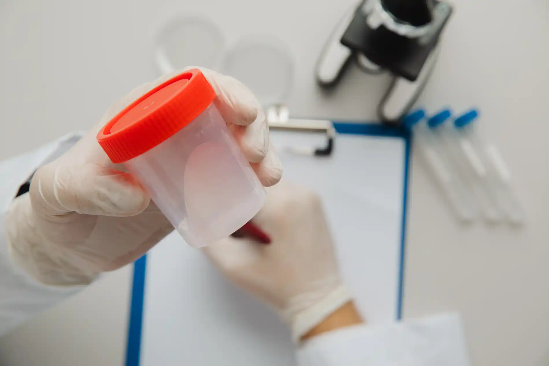 SEMINOGRAMA (ESPERMATOBIOSCOPIA DIRECTA)